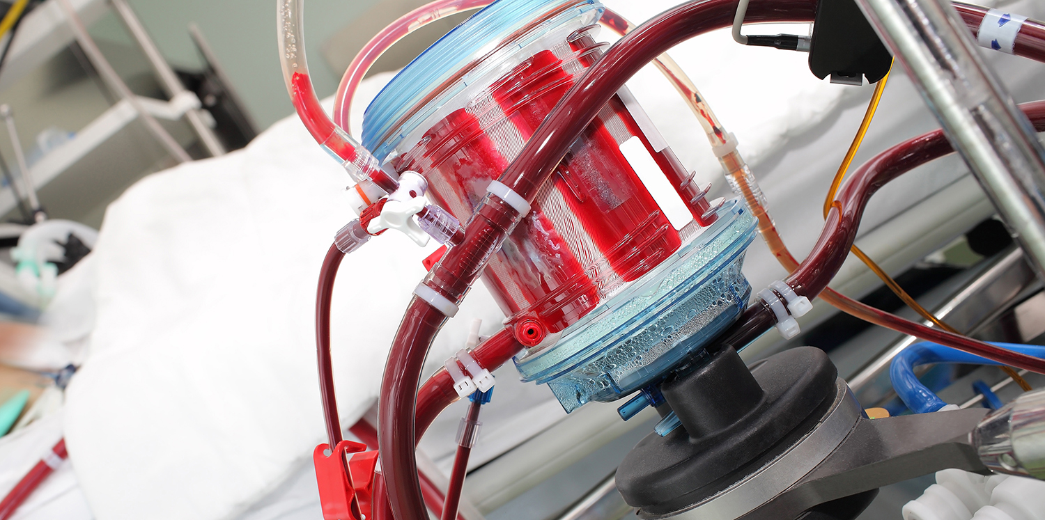 best-practices-and-quality-initiatives-oxygenator